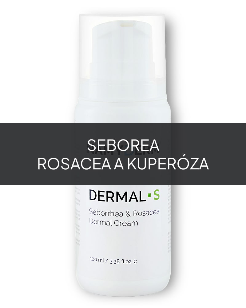 Dermal S | Přírodní dermální krém | Seborea | Rosacea | Kuperóza