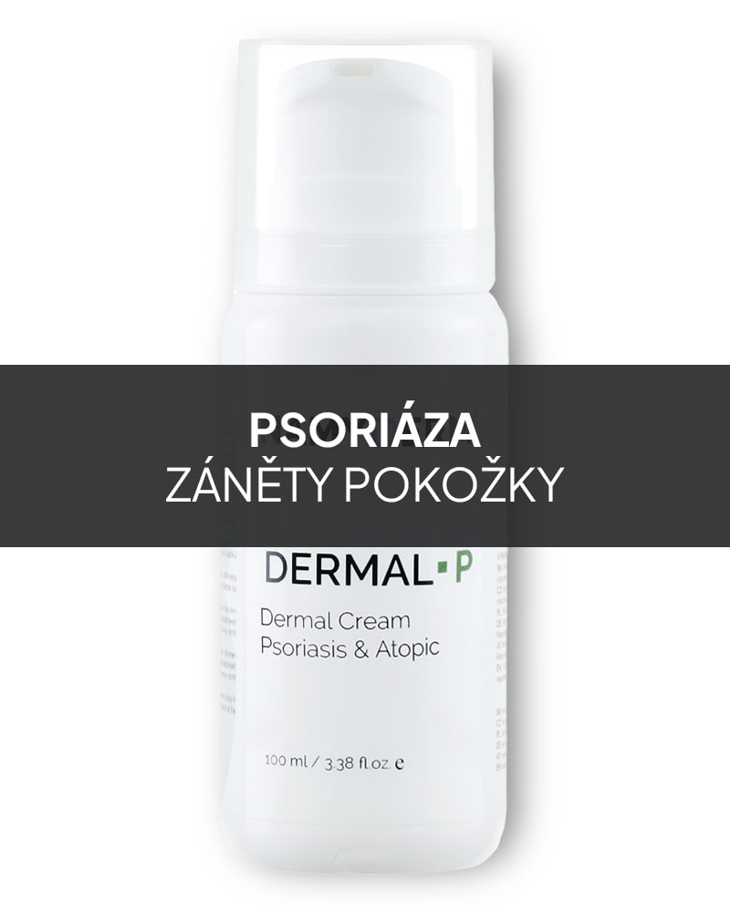 Dermal P – přírodní dermální krém na psoriázu