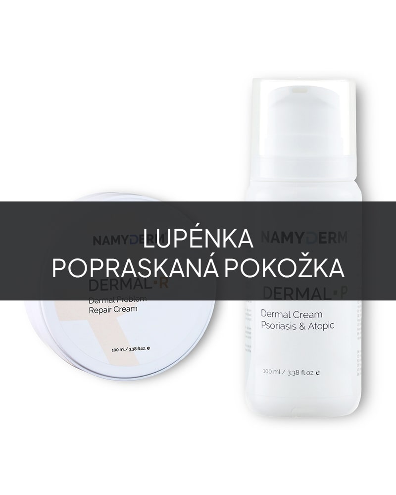 Lupénka – Balíček dermálních krémů